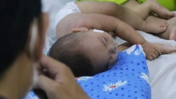 Số ca mắc sốt xuất huyết, tay chân miệng và sởi tại TP.HCM tăng