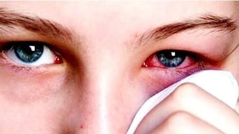 Bệnh đau mắt đỏ có thể bùng phát thành dịch sau lũ, phòng tránh thế nào?