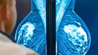 Khi nào cần khám sàng lọc ung thư?