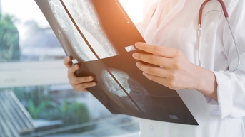 Vì sao nên tầm soát ung thư từ tuổi 40?