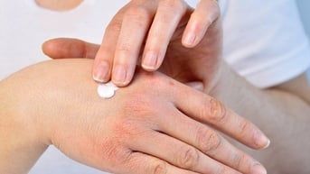 Ngứa da khi trời lạnh, cần làm gì để nhanh khỏi?