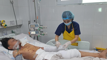 Hiểm họa thương tích từ pháo tự chế