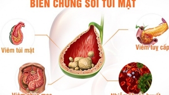 អ្នក​ជំងឺ​ជាប់​គ្នា​ត្រូវ​សម្រាក​ព្យាបាល​នៅ​មន្ទីរពេទ្យ​ដោយសារ​ផលវិបាក​គ្រួស​ក្នុង​ថង់ទឹកប្រមាត់