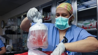 Sau ghép tim, Mỹ ghép thận heo cho người