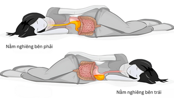 Tư thế ngủ giúp giảm khó tiêu, trào ngược