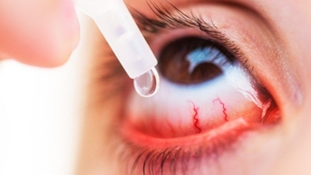 Cảnh báo tình trạng dùng kháng sinh chữa đau mắt đỏ
