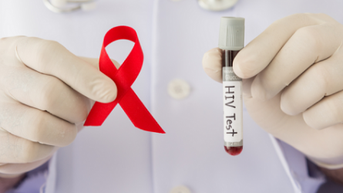 Tổ chức thực hiện các biện pháp can thiệp giảm tác hại trong dự phòng lây nhiễm HIV
