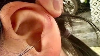 Vụ cô giáo "tác động vật lý": Nhiều học sinh bị xoắn tai, đánh vào đầu