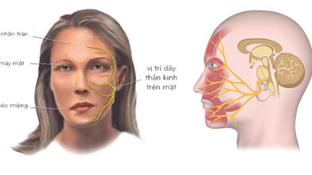 Thời tiết miền Bắc chuyển lạnh, coi chừng liệt dây thần kinh số 7