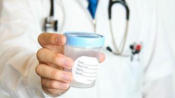 Lầm tưởng tinh trùng yếu do xét nghiệm sai thời điểm