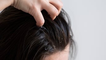 Thủ phạm khiến tóc bạc sớm