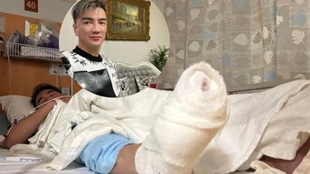 Mr Đàm dời liveshow vì ngã từ trên cao khi biểu diễn tại Mỹ