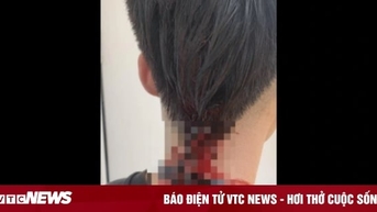 Mâu thuẫn cá nhân, sinh viên Đại học FPT đánh bạn chảy máu tại trường học