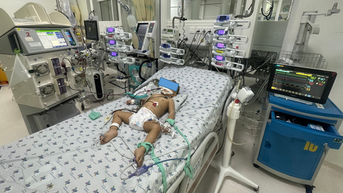 Sau 3 ngày mắc tay chân miệng, bé trai 17 tháng phải lọc máu