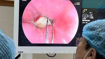 Mắc xương heo trong cổ khi ăn cháo, người đàn ông khó thở phải cấp cứu