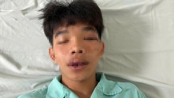 Một học sinh cấp 3 bị đánh hội đồng trước cổng trường ở Bình Phước