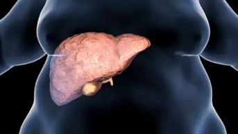 Tăng cân có gây hại cho gan?