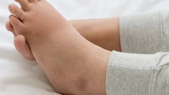 Bé 10 tuổi mắc tình trạng hiếm gặp được mệnh danh là ‘căn bệnh đau đớn nhất’