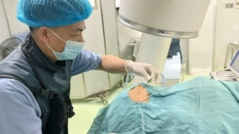 Đau dây thần kinh số 5 dễ bị chẩn đoán nhầm