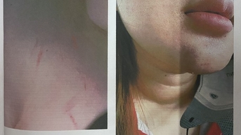 Nữ sinh bị phụ huynh đánh 'hội đồng' gây thương tích, nhà trường nói gì?