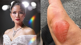 Chân sưng phồng, H'Hen Niê nén cơn đau diễn catwalk tự tin