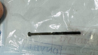 Gắp đinh vít dài 4 cm trong dạ dày bé trai 3 tuổi