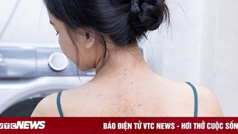 Chia sẻ của bác sĩ Đào Xuân Hưởng về phương pháp trị viêm nang lông 