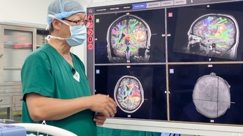 AI 로봇으로 뇌수술 받는 환자, 노래 부르며 수술받아