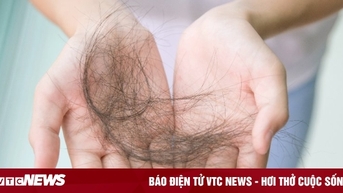 Sau hóa trị ung thư, bao lâu thì tóc mọc lại?
