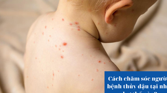 Cách chăm sóc người bệnh thủy đậu tại nhà như thế nào?