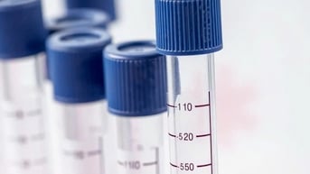 HMPV là loại virus gì, phòng ngừa thế nào?