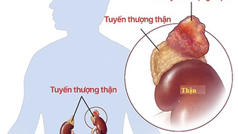 Trẻ bị cao huyết áp do bệnh hiếm