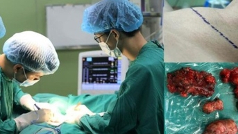 Thanh niên 24 tuổi phát hiện ung thư tuyến giáp vì mắc 1 sai lầm mà nhiều người Việt mắc phải