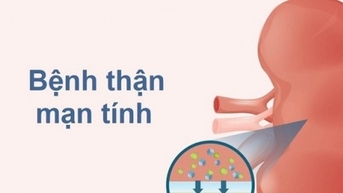 Đề xuất thêm một số bệnh vào Chiến lược quốc gia bệnh không lây nhiễm