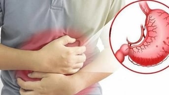 Người đàn ông 38 tuổi ở Phú Thọ thủng dạ dày vì thói quen nhiều người Việt mắc phải