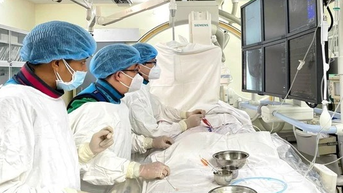 Nguyên nhân đột quỵ sau giác hơi tại nhà