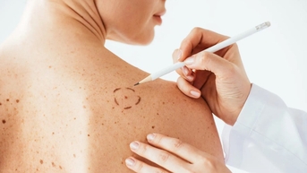 Công nghệ mới ngăn chặn sự lây lan của khối u ác tính