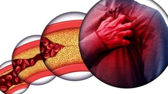 Đồ uống tuyệt vời giảm cholesterol, nhiều người dùng hằng ngày mà không biết