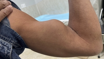 Chấn thương ngầm khi chơi thể thao ít được chú ý
