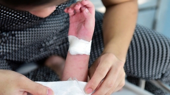Trí tuệ nhân tạo là công cụ tiềm năng trong phòng chống bệnh truyền nhiễm