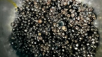 ដុំថ្មរាប់ពាន់ដុំនៅក្នុងថង់ទឹកប្រមាត់របស់ស្ត្រីចំណាស់។