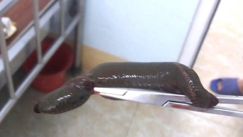 Cụ ông 71 tuổi cầu cứu bác sỹ vì đỉa chui vào “của quý”