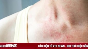 Phân biệt mẩn đỏ thông thường và ung thư da