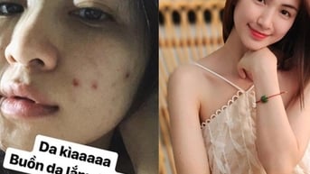 Hòa Minzy tiết lộ loại rau giúp làn da cô trắng mịn, mùa hè nên ăn để thải độc và kéo dài tuổi thọ