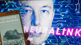 Startup thần kinh của Elon Musk cấy ghép thành công chip lên não người