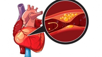Nhồi máu cơ tim cấp vì thói quen hút thuốc lá và cảnh báo từ chuyên gia