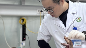 Tai nạn bình gas mini phát nổ khi đang nấu ăn, một người đàn ông phải cắt bỏ chân