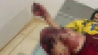 수제 폭죽을 만든 학생 4명, 병원 이송