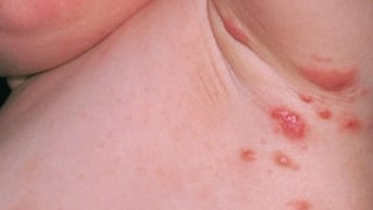 5 cách bảo vệ da cho trẻ dịp Tết phụ huynh cần biết