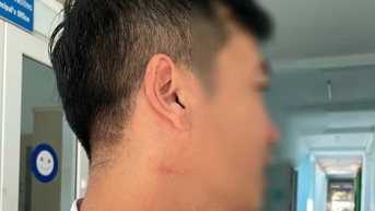 Thầy giáo bị đồng nghiệp bóp cổ ngay sân trường